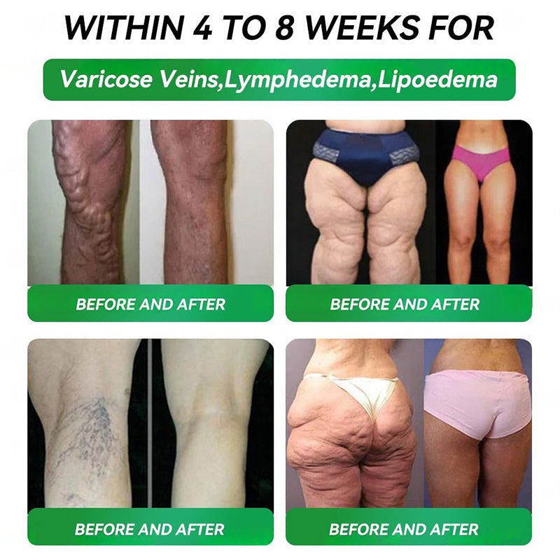 50%OFF! LAST SOLD TODAY!! ⤠Official StorešNATRAVORĀ®10-in-1 Multi-Functional Vitality Oral Solutionš©āā¤ļøāšØ(Just once a day,visible changes in 7 days)ā
For obesity,cardiovascular health,diabetes,sleep apnea,Gut Health,joint issues,and more